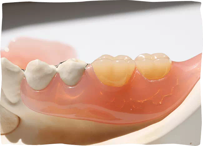 義歯・インプラント・歯の移植